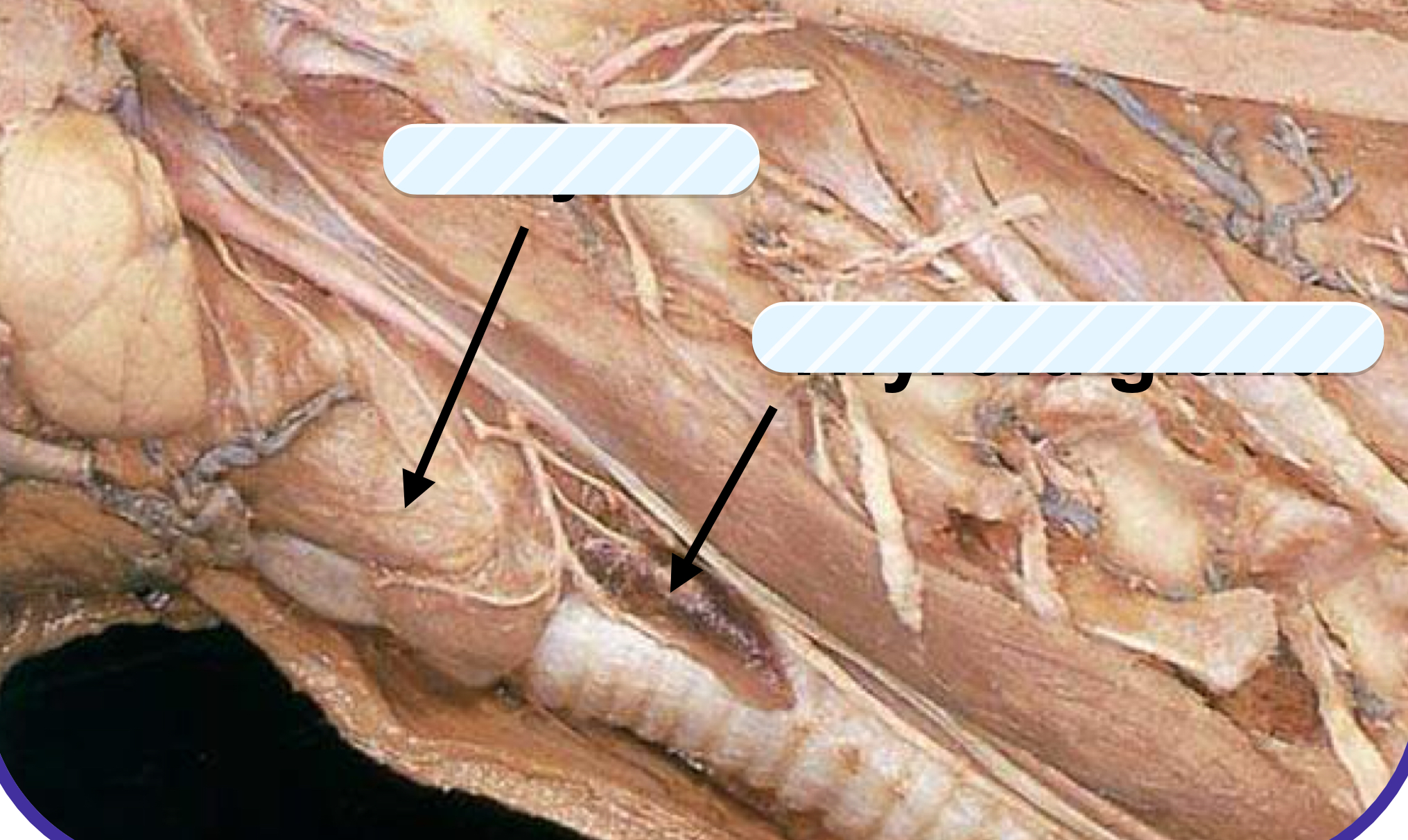 <p>what structure is the arrow pointing to on the left?</p>