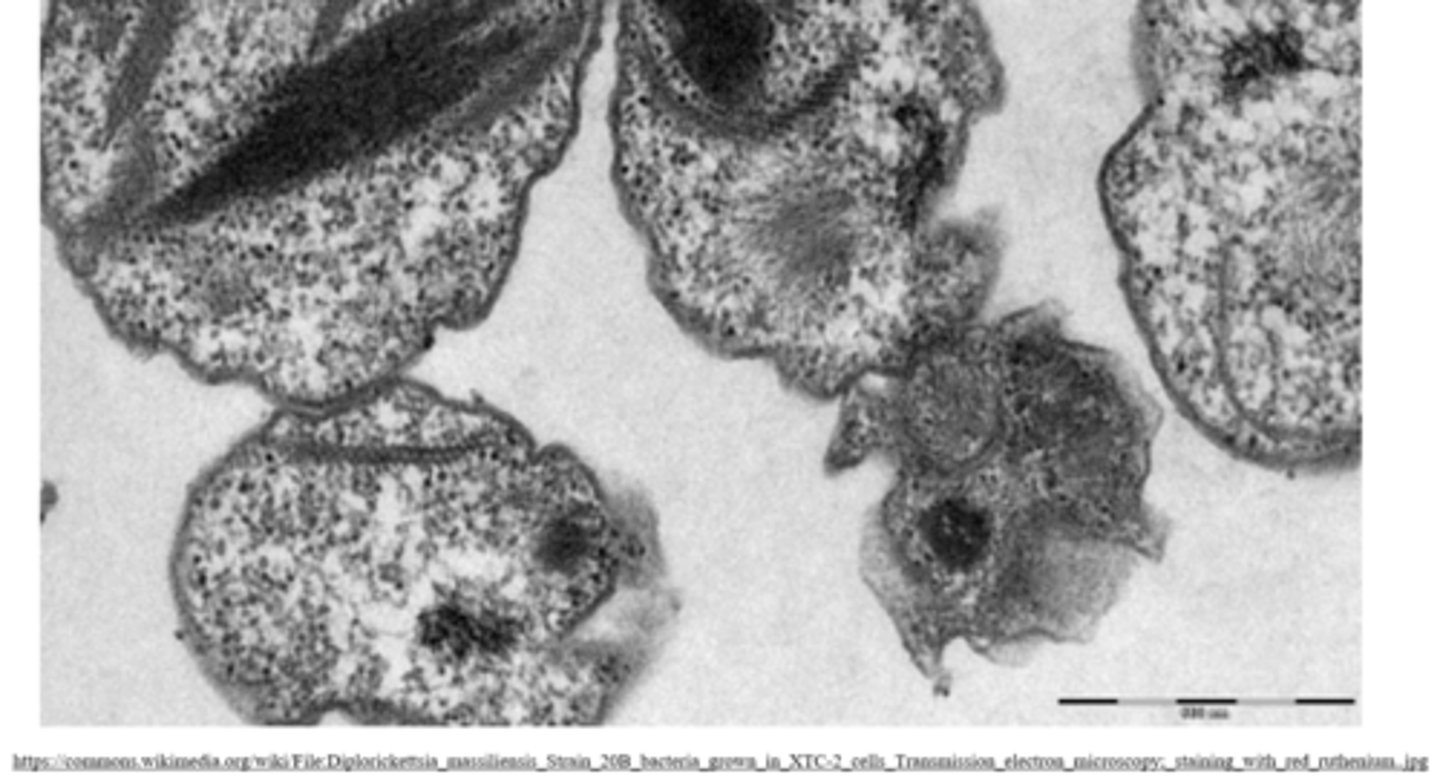 <p>transmission electron microscopy (TEM)</p>