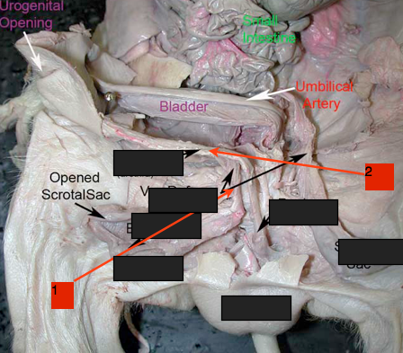 -Makes up the urogenital duct
-Part of the Male Reproduction Tract