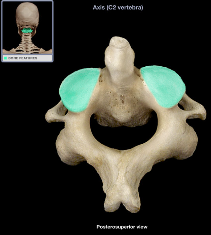 <ul><li><p>Location: Axis, Superior articular process</p></li><li><p>Description: Smooth area</p></li></ul><p></p>