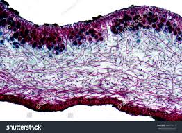 <p><span>crustose</span></p><p><span>foliose</span></p><p><span>fruticose</span></p>