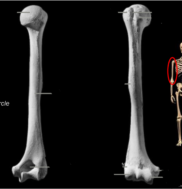 <p>Identify the deltoid tuberosity</p>