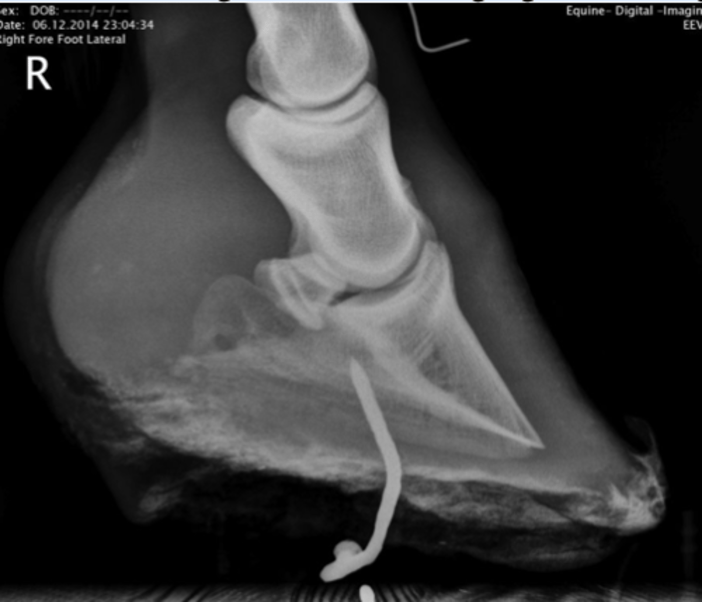 <p>En hest har indtrådt et fremmedlegeme. Med hvilken blokade kan du mest specifikt få bedøvet området inden ekstraktion af fremmedelegemet, sondering og udskæring?</p><p>- Hovledsblokade</p><p>- Ramusblokade</p><p>- Lav ledningsblokade under koden (mid-pastern ring block)</p><p>- Lav ledningsblokade (abaxial sesamoid block)</p>