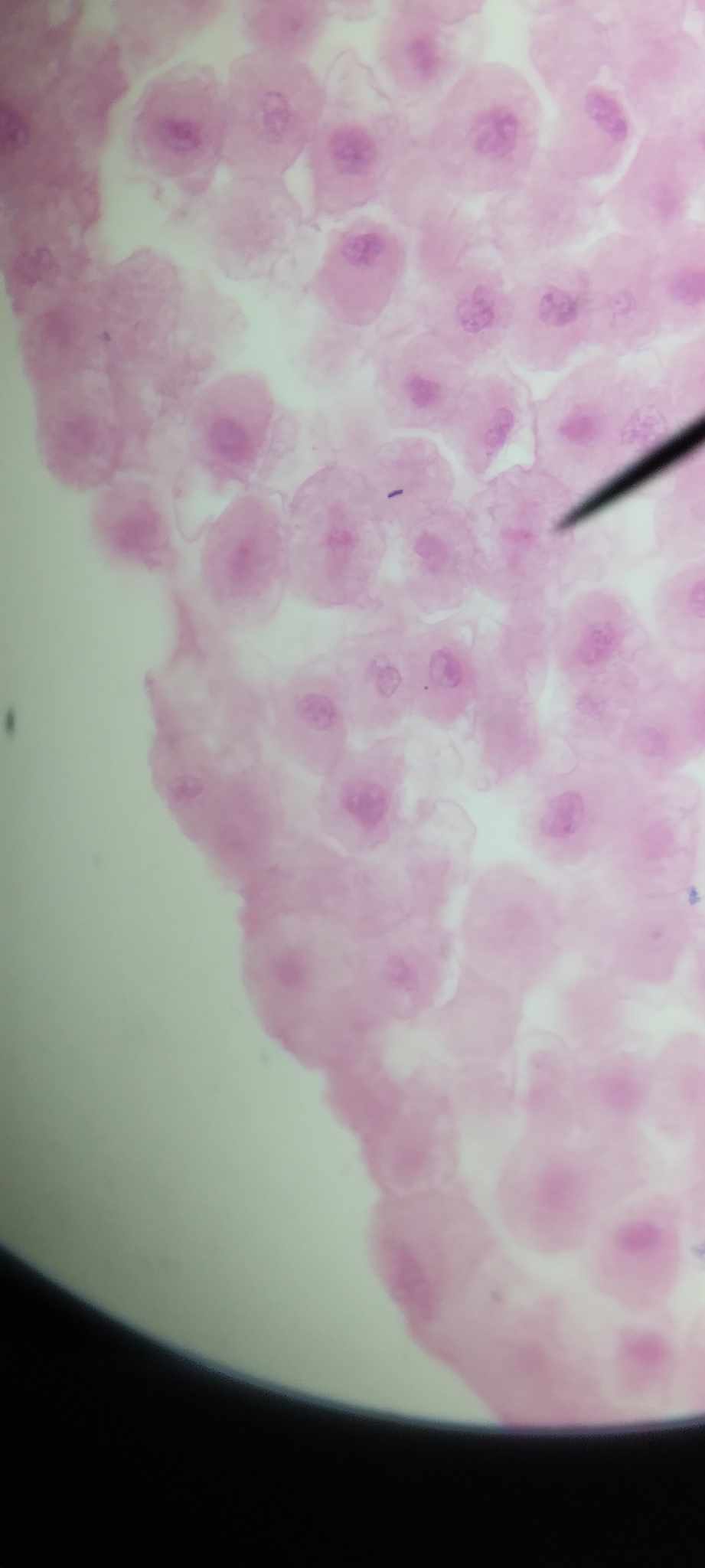 <p>chromosomes are aligned in the middle; spindle fibers extending from one centriolee (centrosomes) to the other; chromosomes are attached to some fibers by their centromeres</p>