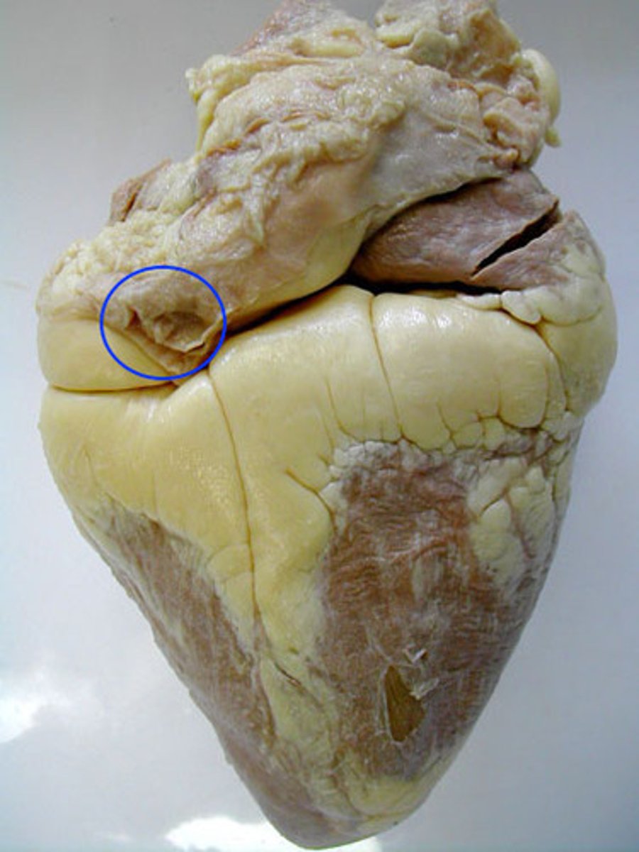 <p>Identify the blood vessel that carries blood from the lungs to the left atrium</p>
