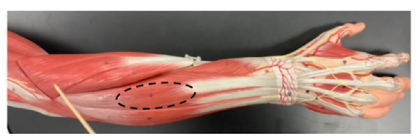 <p>next to extensor carpi ulnaris muscle (pack 2) (extensor side more medial)</p>
