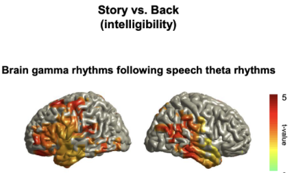 <p>HF (gamma) speech tracking is more left-lateralised </p>