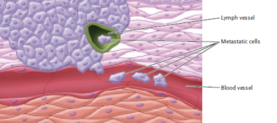 <p>Cells from malignant tumours leave and spread to different areas of the body to form new tumours.</p>