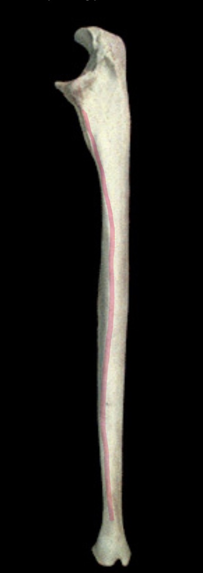 <p>What structure is this?</p>