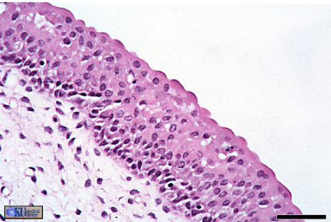 <p>Description: Multiple layers of cells that can change shape depending on the degree of stretching. </p><p>Function: Stretches readily and permits distension of urinary organ by contained urine </p><p>Location: Lines the ureters, bladder, and part of the urethra </p>