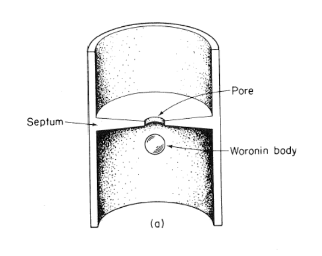 <p>Central pore   (Ch. 5)</p>