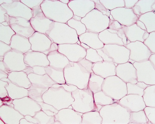 <p>Name the tissue</p>