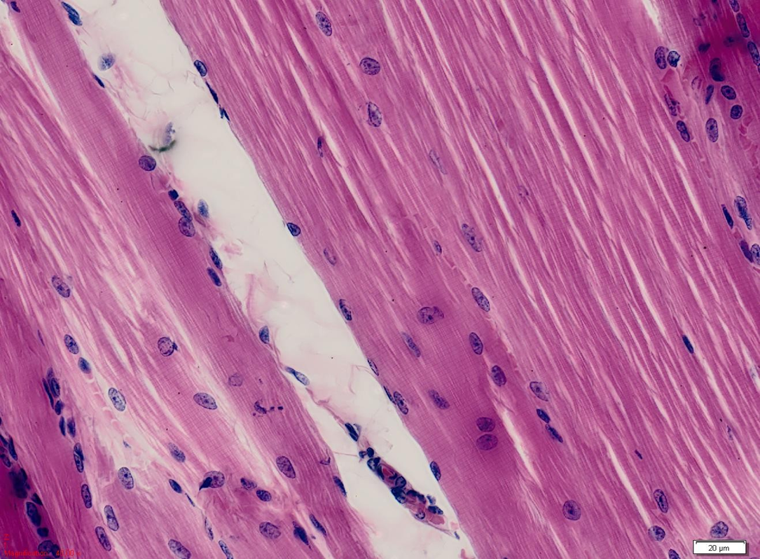 <ul><li><p>hematoxyline (blauwe, basische kleurstof) → gaat naar zure plaasten</p></li><li><p>eosine (roze, zure kleurstof) → gaat naar basische plaatsen</p></li><li><p>2 componenten;</p><ul><li><p>chromofoor = kleurdrager</p></li><li><p>auxochroom = maakt kleurstof wateroplosbaar + bindt chromofoor aan weefsel</p></li></ul></li><li><p>pH van kleurmilieu zeer bepalend voor resultaat van de kleuring; belang van iso-elektrisch punt (IEP)</p></li><li><p>niet mogelijk bij sacchariden en lipiden</p></li></ul><p></p>