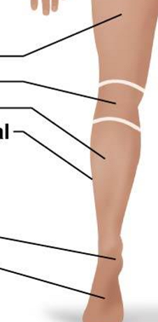 <p>Posterior Appendicular Region: Lower Limb and Pedal </p>