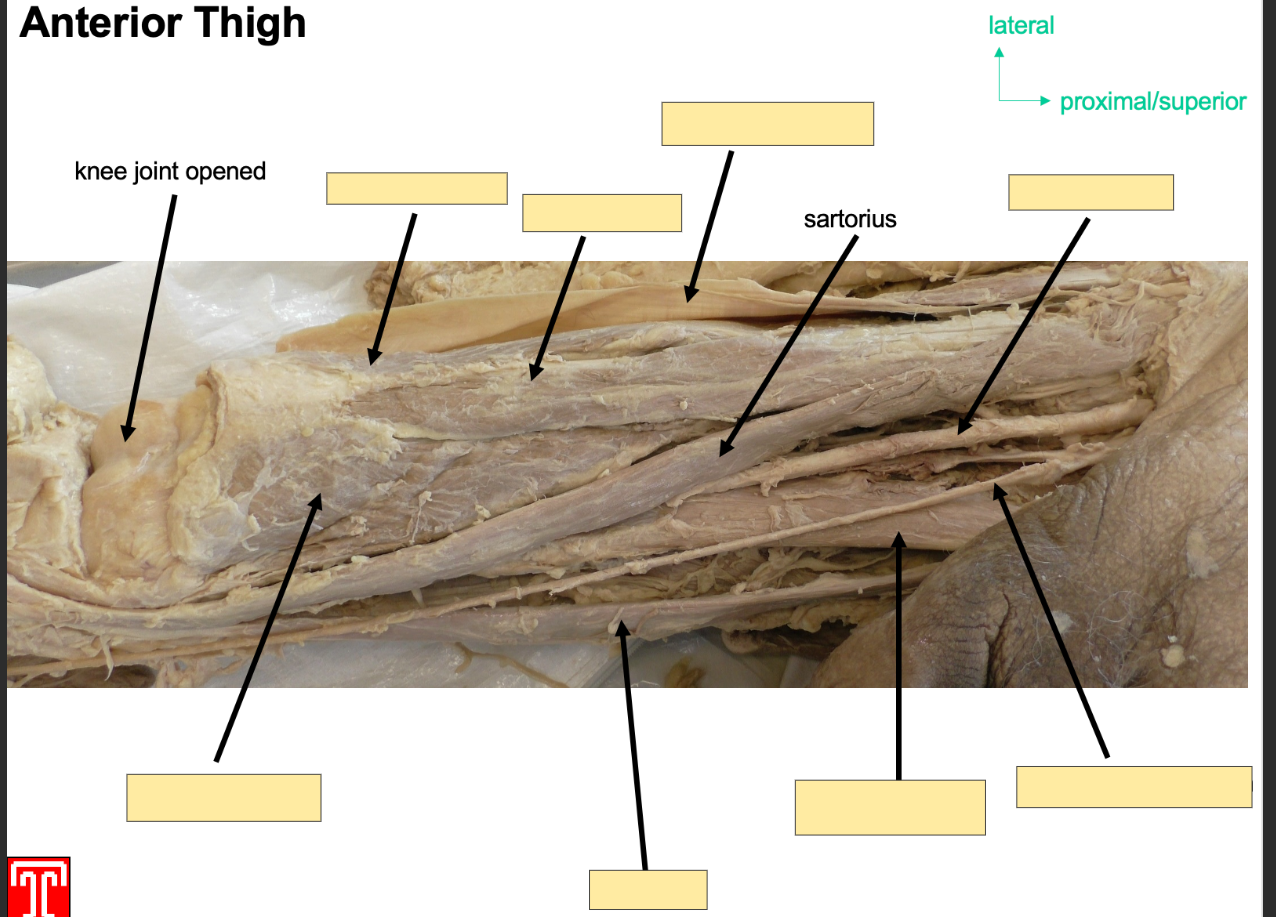 <p>Part of the anteiror compartment of the thigh </p><p></p><p>Longest muscle in body, runs infermedial deirection </p><p></p><p>Attachment: orginates: anterior superior iliac spine </p><p>Sttaches to superior, medial surface of tibia </p><p></p><p>Action: Flexor at hip, abductor and lateral rotator, also fleor at knee joint </p><p></p><p>Innervation: Femoral Nerve </p><p>Artery: Femoral Artery </p>