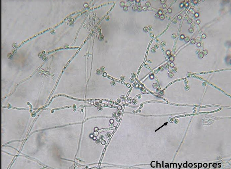 <p><em>Candida</em>; Kingdom Fungi, Phylum Deuteromycota</p>