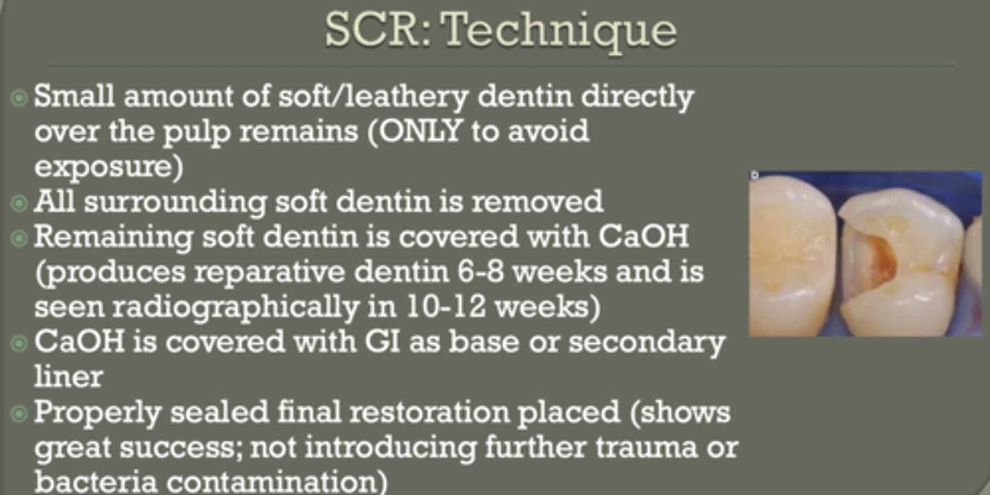<p>- remove surrounding caries</p><p>- leave soft dentin at pulp (or leathery... only to avoid exposure)</p><p>- cover with CaOH</p><p>- cover with GI</p><p>- seal restoration ( no trauma or bacteria contamination)</p>