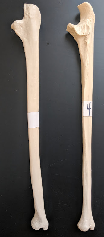 <p>Name this bone</p>