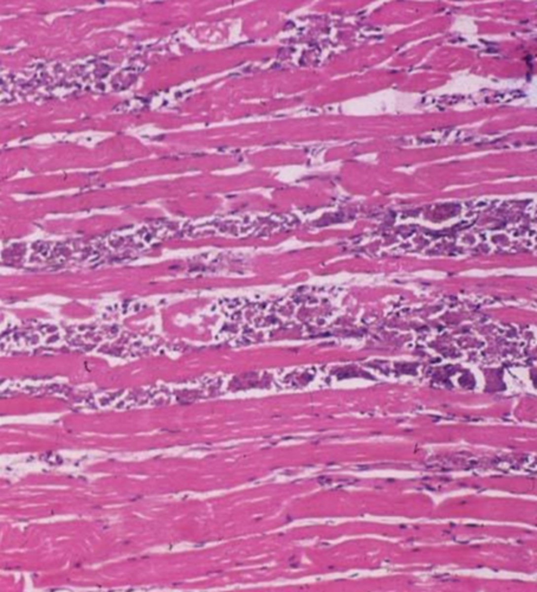 <p>is this dystrophic or metastatic?</p>