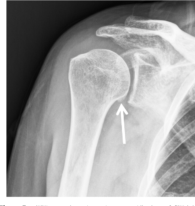 <p>What position is demonstrated?</p>