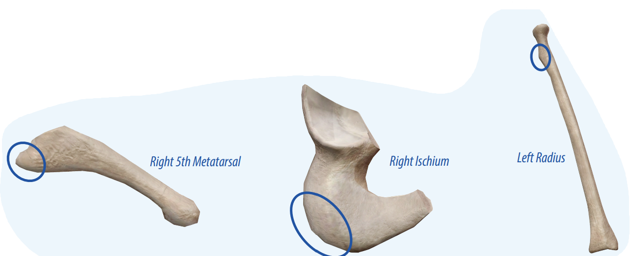 <p>A moderate projection that allows connective tissues to connect to the bone.</p>