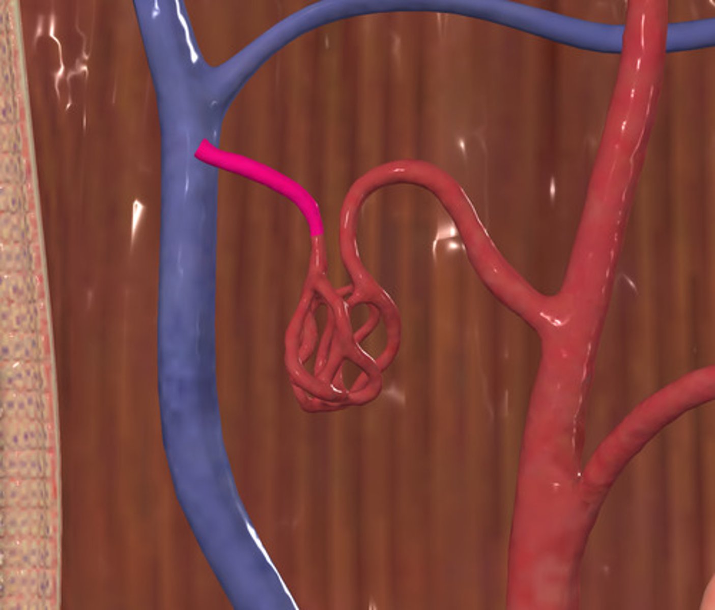 <p>ID Vessel Highlighted Pink</p>