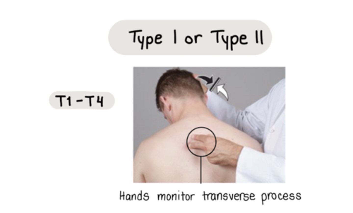 <p>hands monitor transverse process</p><p>direct: moving pt INTO barrier in ALL PLANES</p><p>active: pt moves back toward direction of freedom in one plane</p>