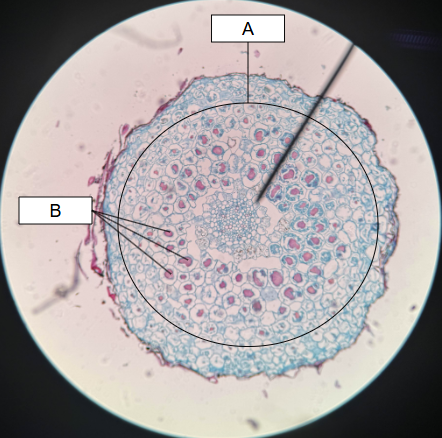 <p>What type of micorrhizae is this</p>