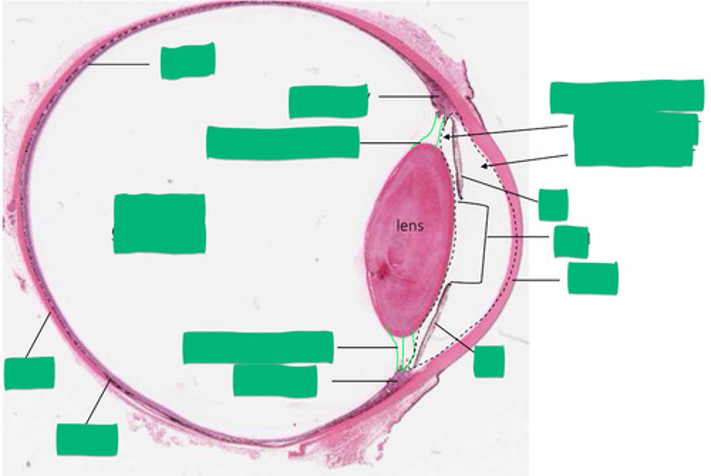 <p>Black dashed line</p>