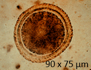 <p>What type of egg is shown?</p>