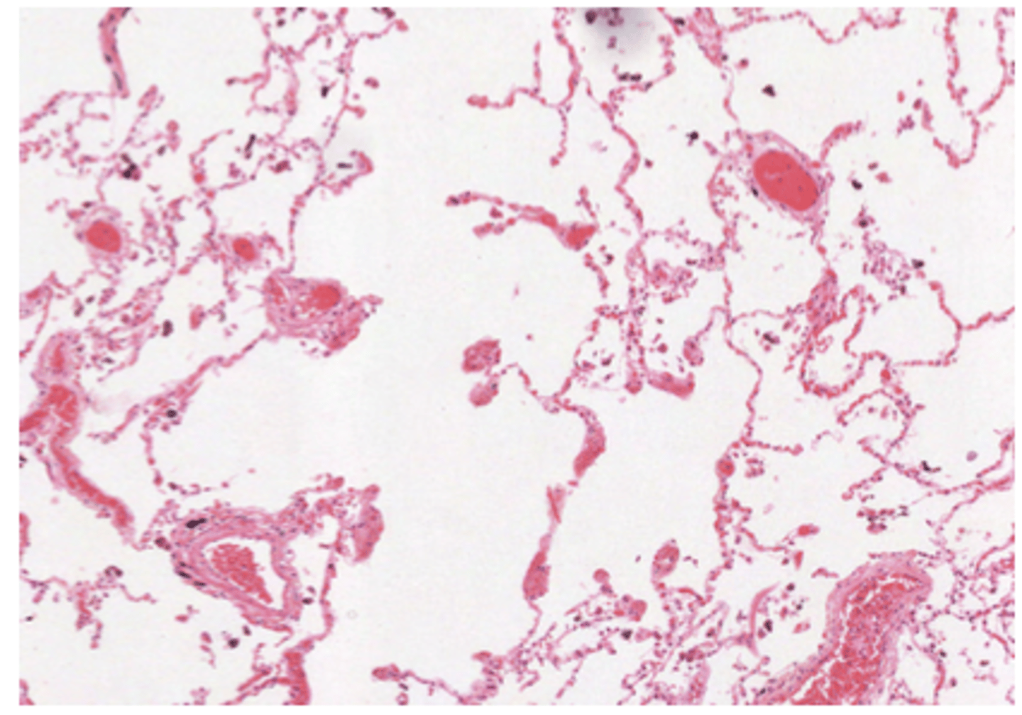 <p>Alveolar epithelium delimiting the sacs, within a region of highly vascularized (capillaries) fibroelastic connective tissue.</p><p>This is the region where exchange will take place.</p><p>VERY THIN WALLS. EMPTY SPACES -&gt; ALVEOLAR SACS WILL BE FILLED WITH AIR</p>