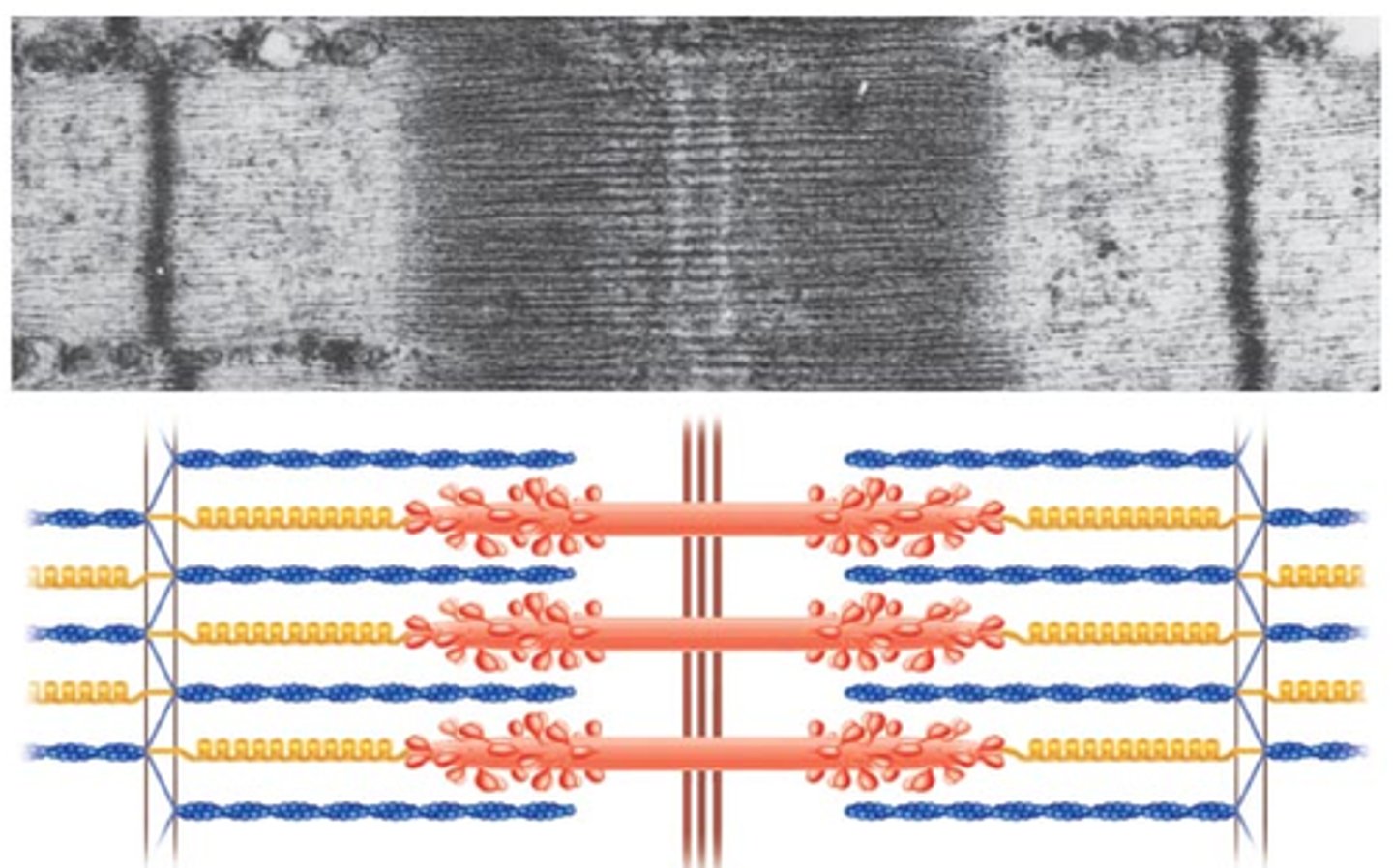 <p>A pattern of light and dark bands (A band appears dark and I bind appears light)</p>