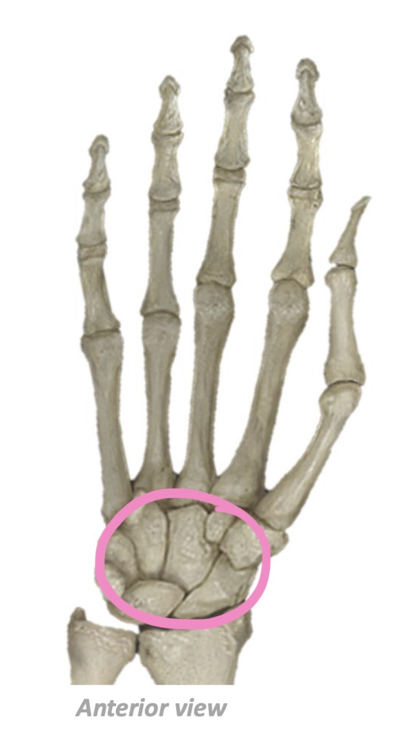 term image