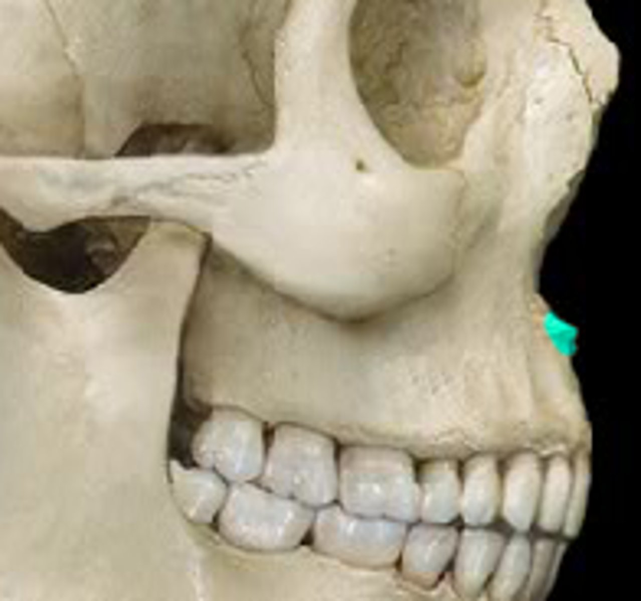 <p>small bony projection located on the median line at the inferior margin of the nasal cavity</p>
