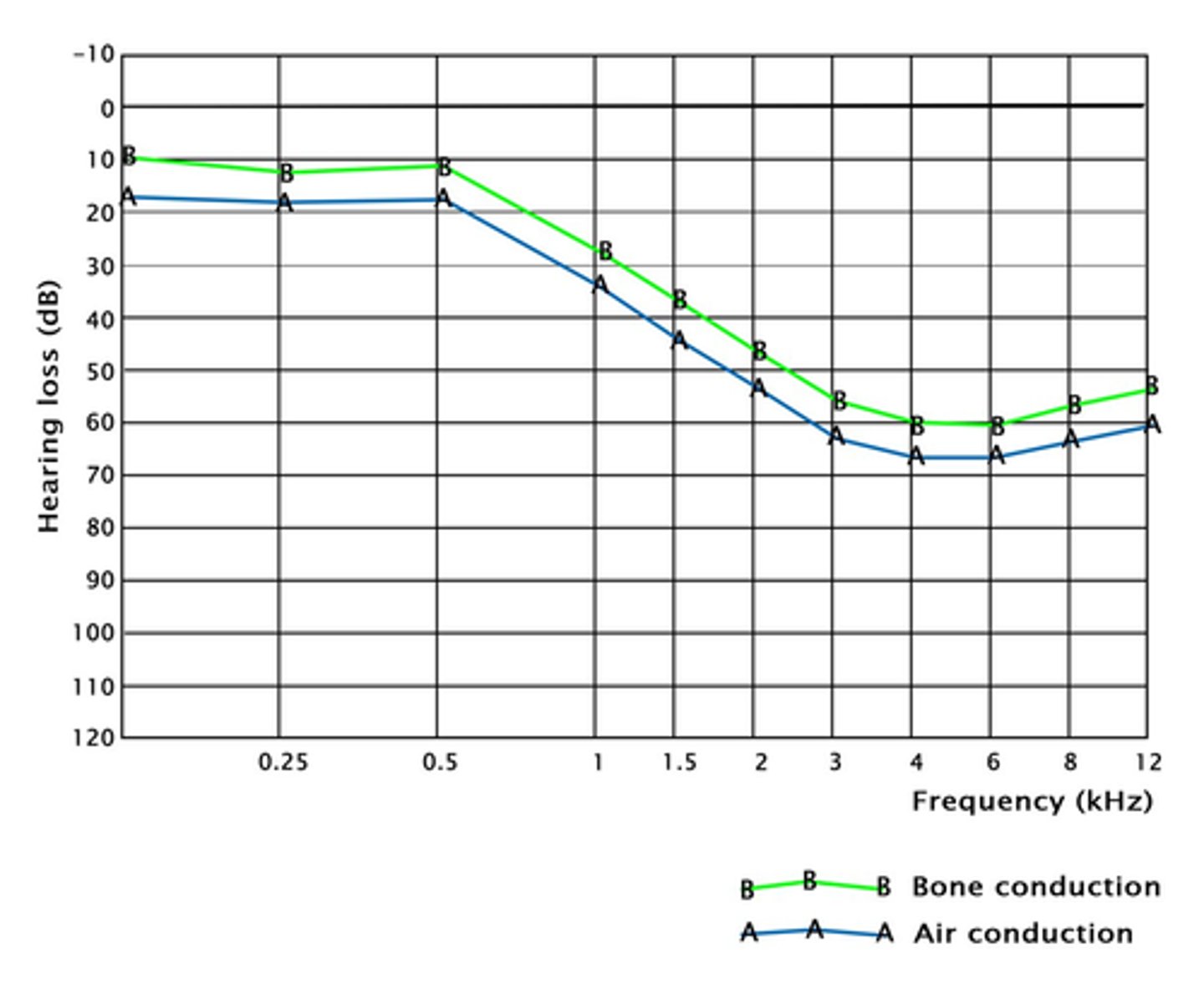 <p>Increasingly deafer at high frequencies</p><p>They struggle to hear higher frequencies in both air and bone conduction</p>