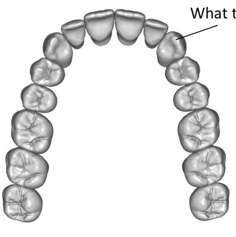 <p>What type of tooth is the line pointing to </p>
