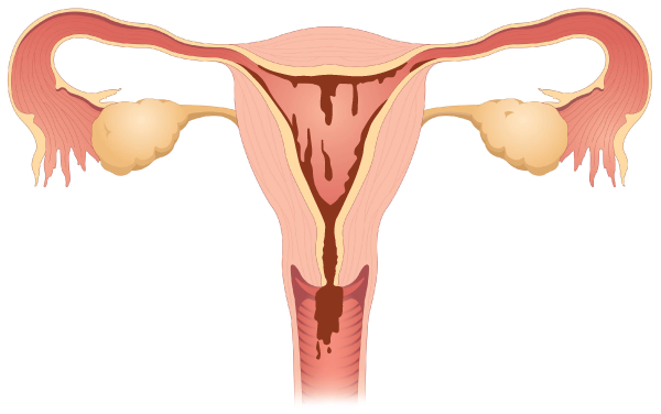 <p>to have/to get period (có kinh nguyệt)</p>