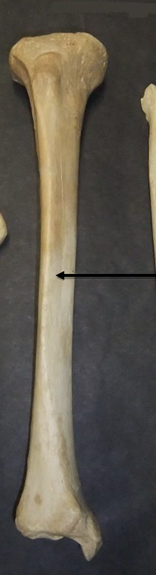 <p>Name this bone </p>