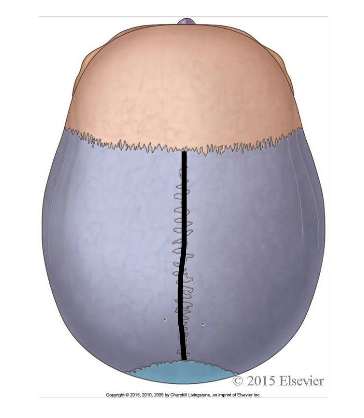 <p>which suture is highlighted here</p>