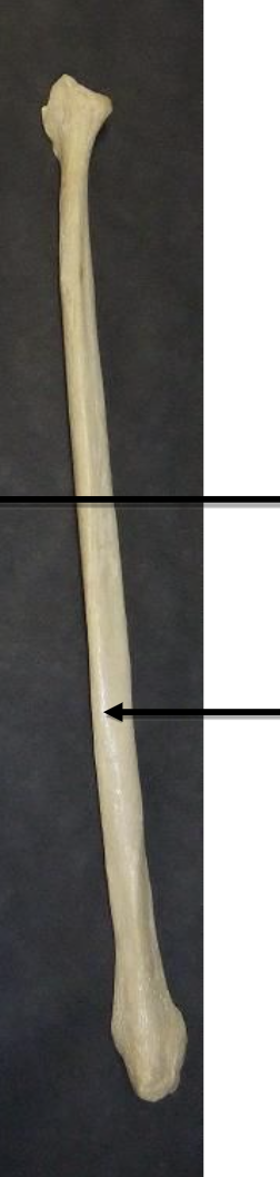 <p>Name this bone </p>