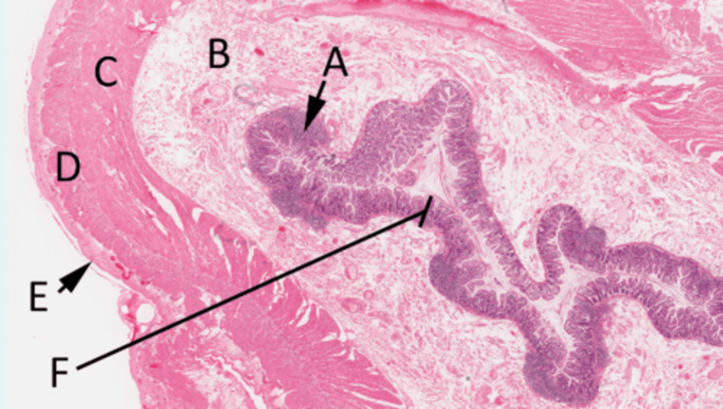 <p>A = MALT</p><p>B = Submucosa</p><p>C = Circular muscle</p><p>D = Longitudinal muscle</p><p>E = Mesothelium (simple squamous epithelium of the serosa)</p><p>F = Mucosa</p>