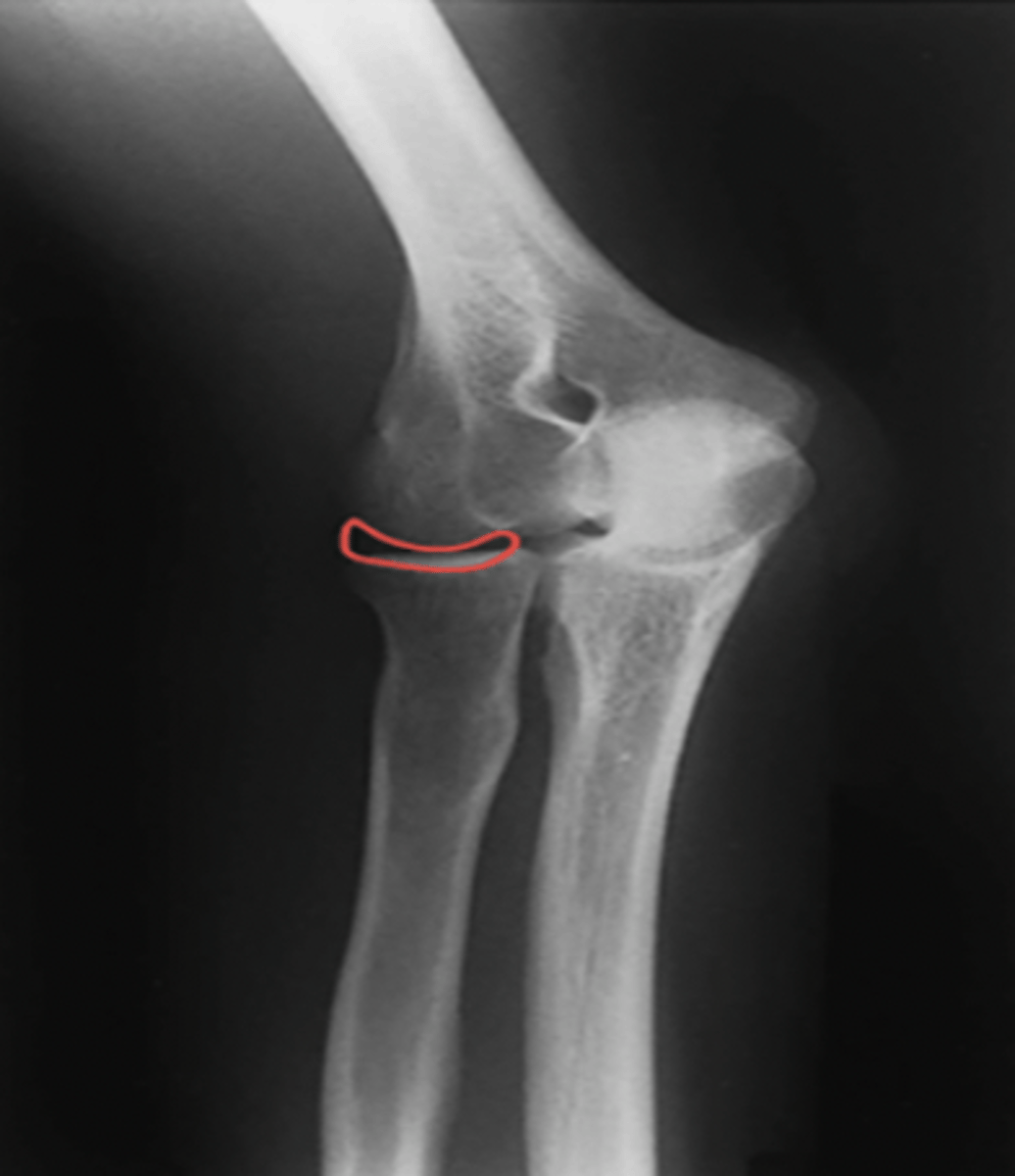 <p>What structure is highlighted?</p>