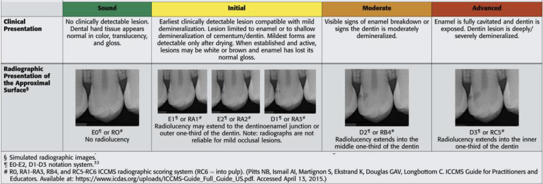 <p>ADA Caries Classification System</p>