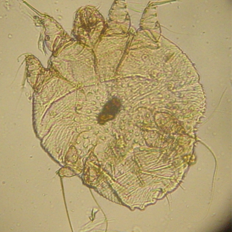 <p><span>Sarcoptes scabiei -</span> burrows into the skin. intense itching+inflammation</p>