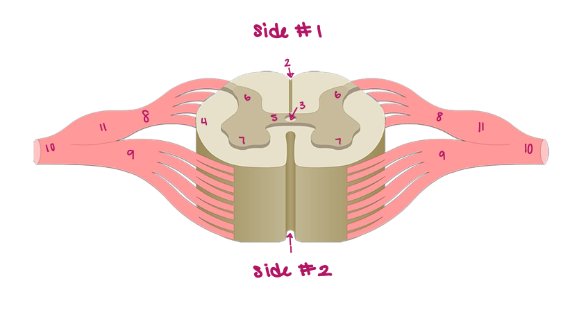 <p>Label figure 11.</p>