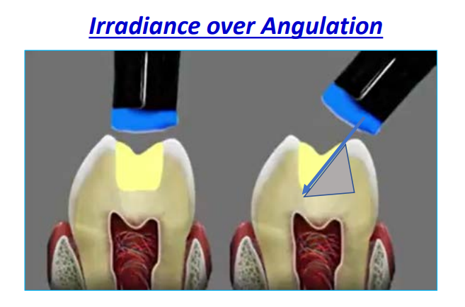<p>distance over angulation</p>