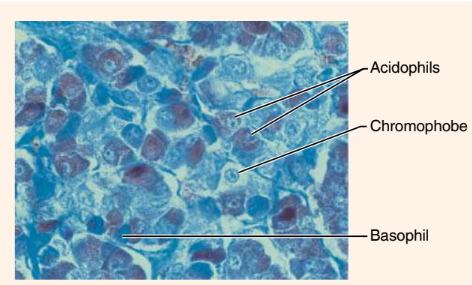 <p>What endocrine organ or gland is this?</p>