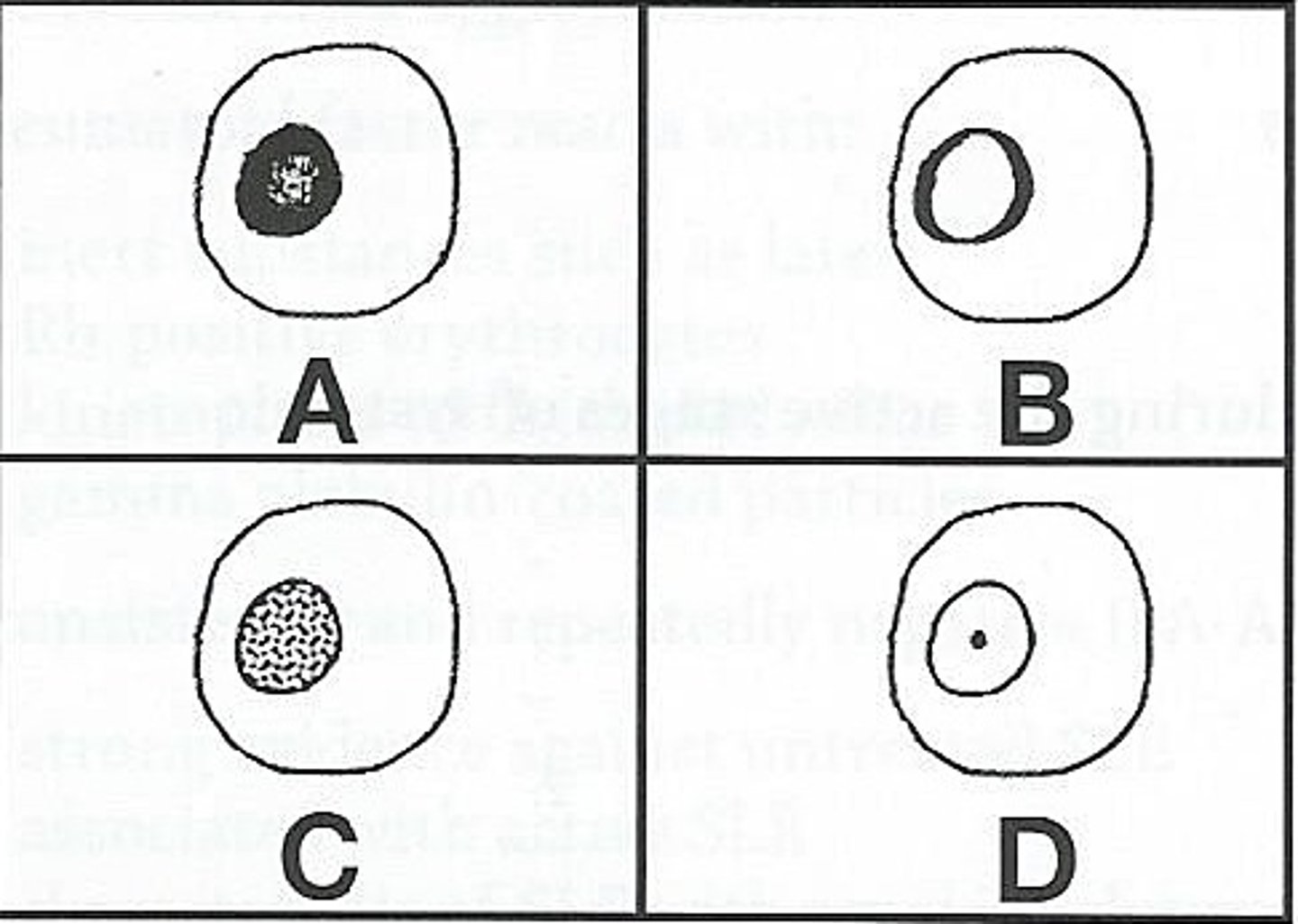 <p>3) Which of the ANA patterns shown above would be associated with high titers of antibodies to the Sm antigen?</p><p>a) diagram A</p><p>b) diagram B</p><p>c) diagram C</p><p>d) diagram D</p>