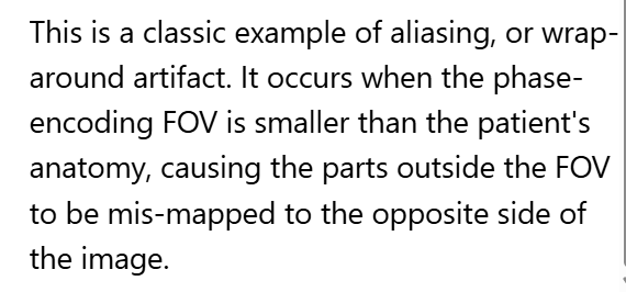 <p>D. Wraparound (aliasing)</p>