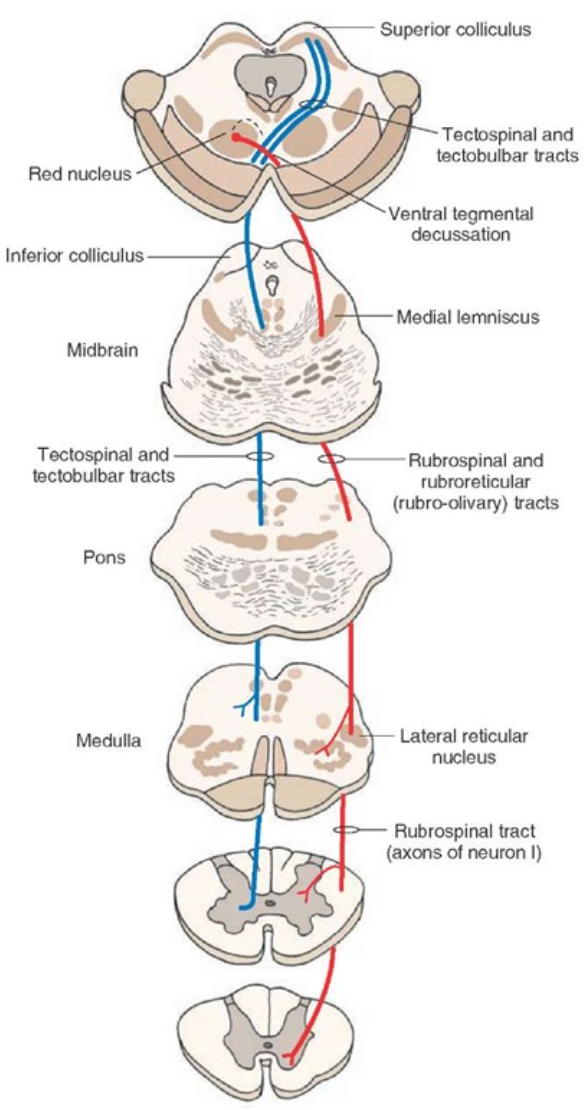 <p>Rubrospinal Tract</p>